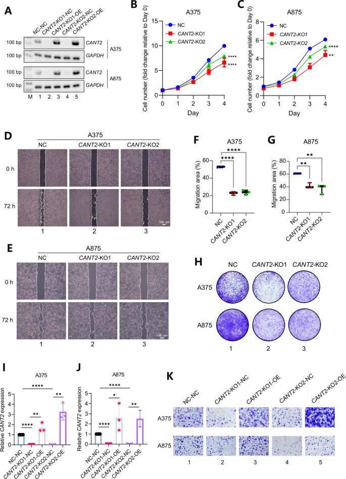 Fig. 2: CANT2 lncRNA enhances the proliferation and migration of tumor cells in vitro.