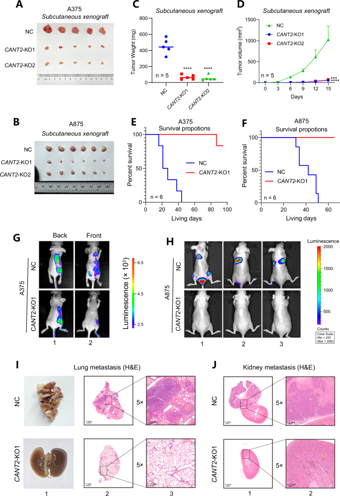 Fig. 3: The presence of CANT2 promotes both tumor growth and metastasis in vivo.