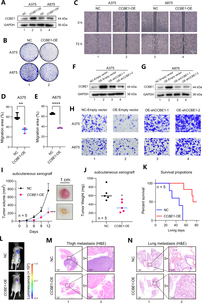 Fig. 6: CCBE1 functions as a tumor suppressor in the tumorigenesis of melanoma.