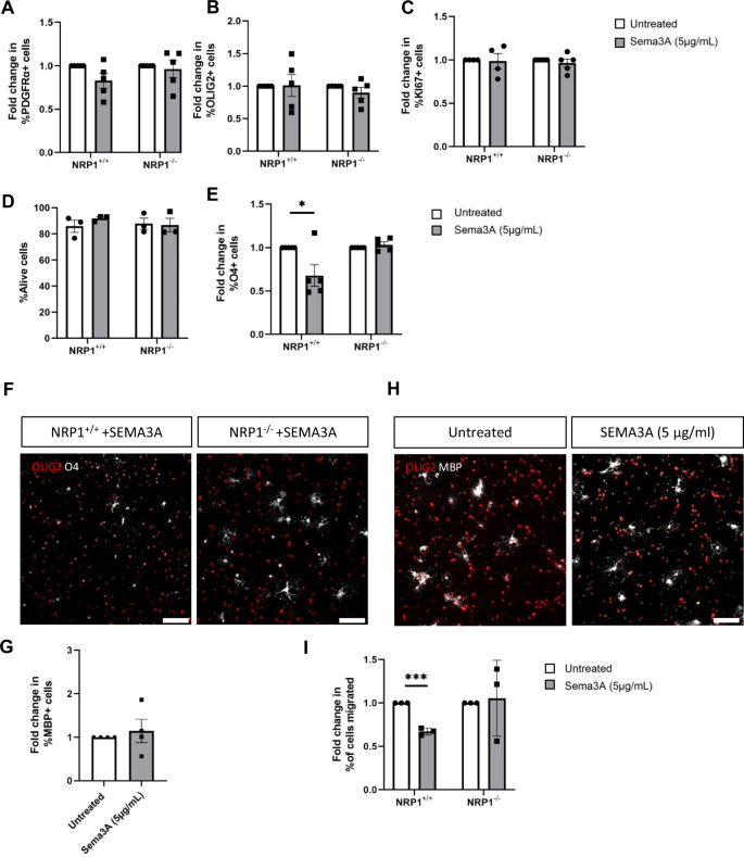 Fig. 2: SEMA3A affects early differentiation of oligodendrocytes and inhibits cell migration.