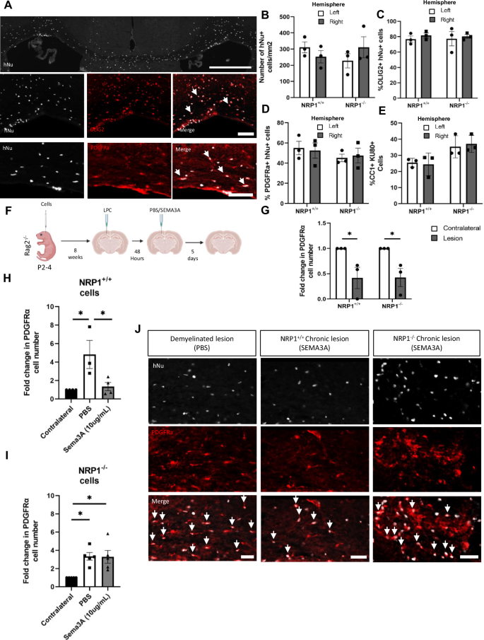 Fig. 4: NRP1−/− hOPCs migrate into chronic lesions following long-term transplantation.