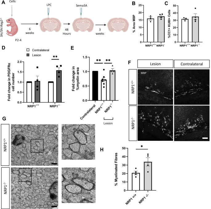Fig. 5: Enhanced migration of NRP1−/− hOPCs leads to improved remyelination.