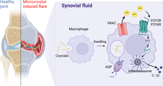 Fig. 8: Signaling pathways involved in micro-crystallin joint inflammation.