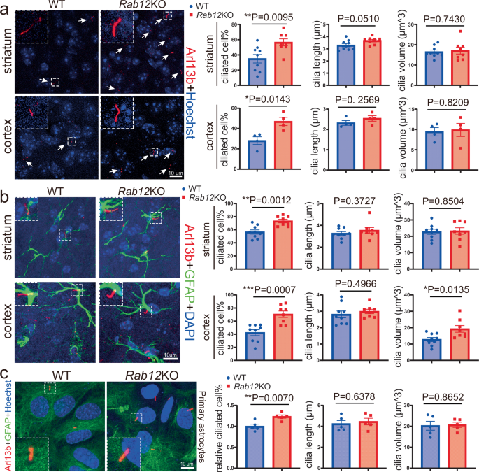 Fig. 2: Characterization of ciliated cells and cilium size in vivo and in vitro.