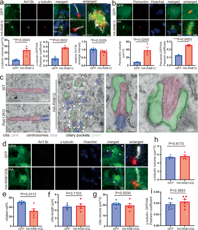 Fig. 3: The effect of RAB12 overexpression on primary cilia and homeostasis of centrosomes in astrocytes.