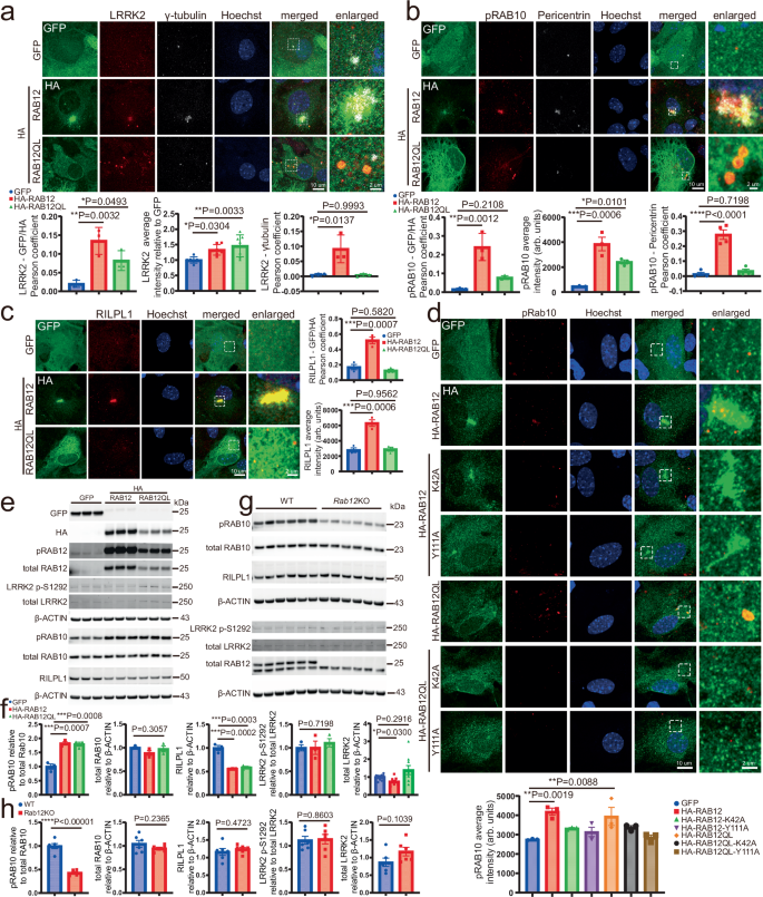 Fig. 5: Examination of LRRK2, pRAB10, and RILPL1 in astrocytes overexpressing RAB12.