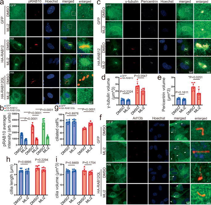 Fig. 6: The impact of LRRK2 kinase activity on RAB12’s cilia formation and centrosome homeostasis effects.
