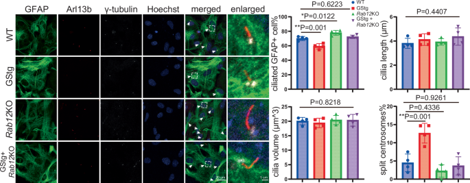 Fig. 7: The effect of RAB12 on the ciliogenesis and centrosome alteration caused by Lrrk2-G2019S in astrocytes.