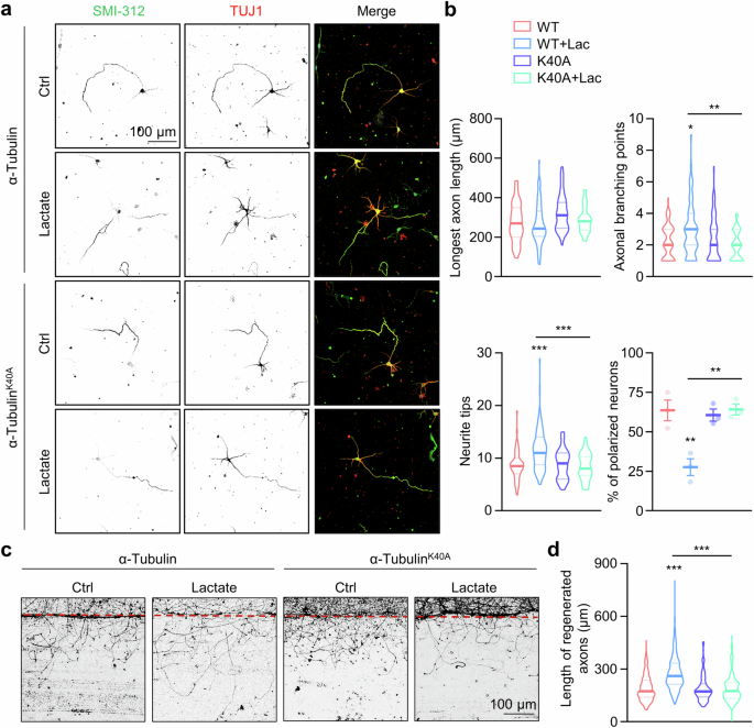Fig. 6: α-Tubulin lactylation promotes axon outgrowth and branching.