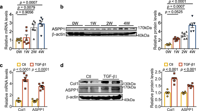 Fig. 1: Upregulation of ASPP1 in fibrotic models.