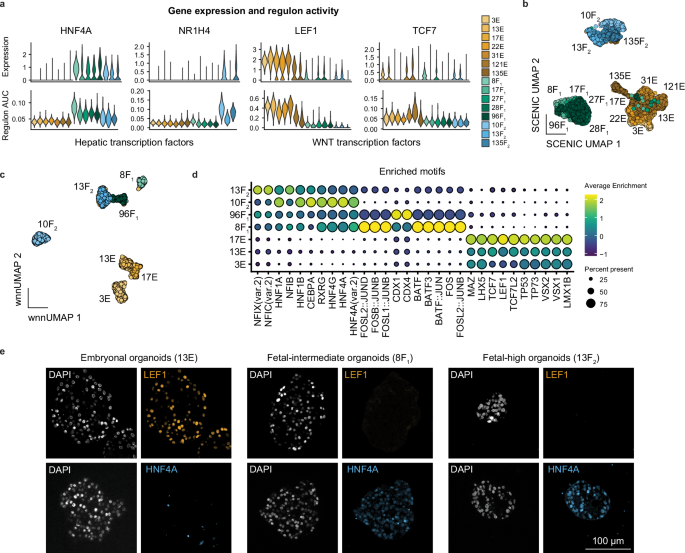 Fig. 5: Single-cell ATAC-seq and SCENIC analysis identify TFs associated with hepatoblastoma subtypes.