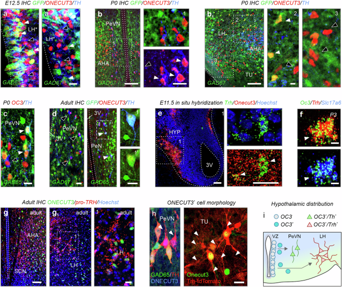 Fig. 4: Neurotransmitter identity of ONECUT3+ neurons.