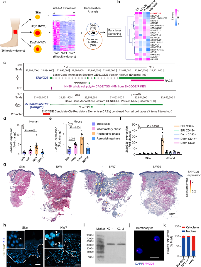 創傷治癒の鍵となる分子を特定(Key molecule in wound healing identified)