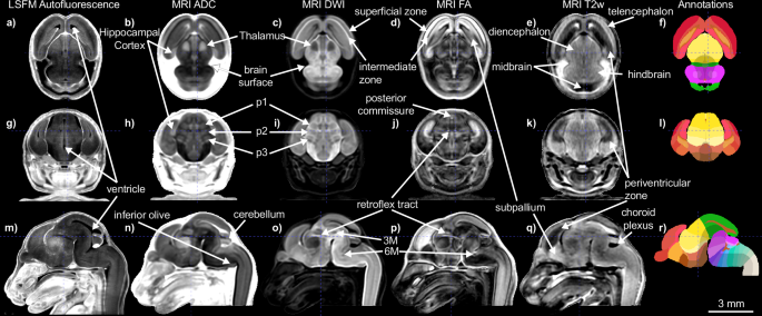 Developmental mouse brain common coordinate framework | Nature 