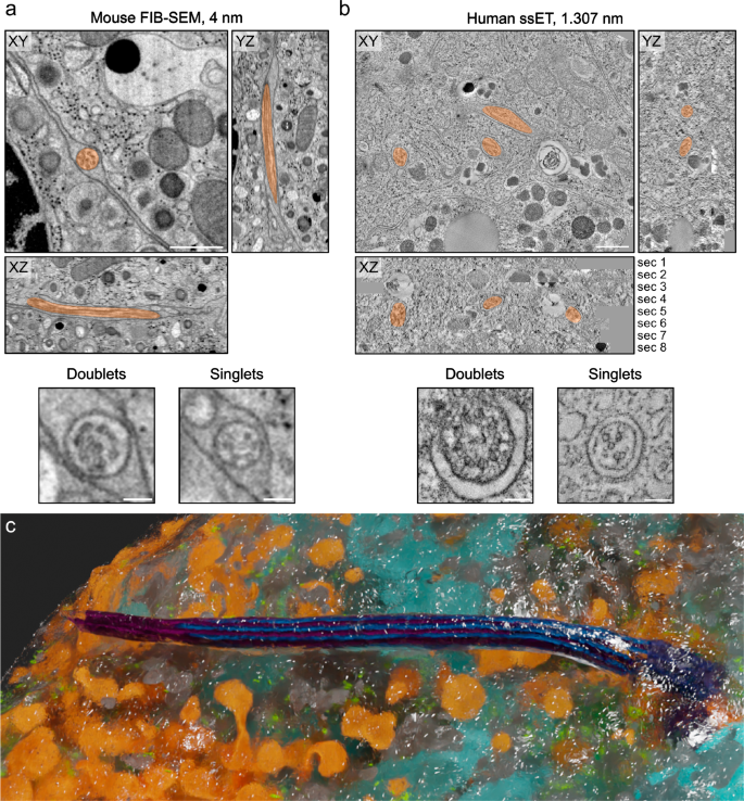 Structure, interaction and nervous connectivity of beta cell 