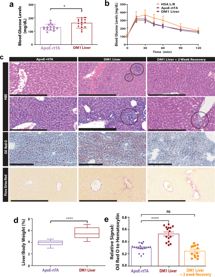Fig. 3: DM1 induces hepatic lipid accumulation and injury.