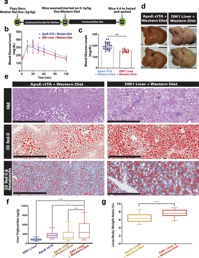 Fig. 5: DM1 exacerbates diet-induced MAFLD severity.