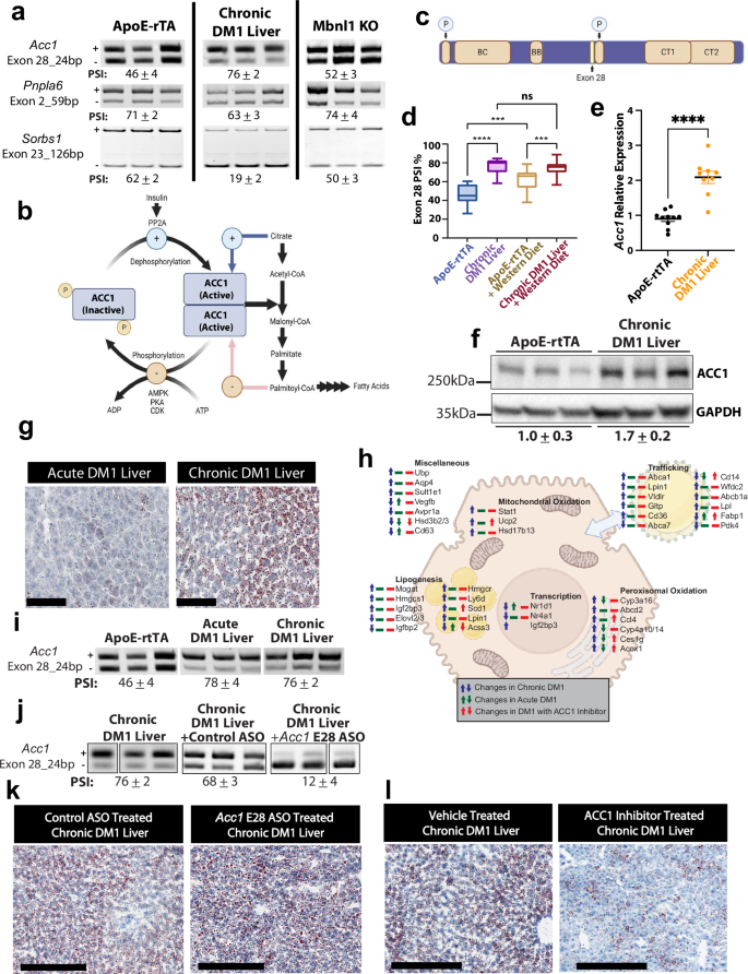 Fig. 6: DM1 disrupts liver lipid regulation and drives lipogenesis via acetyl-CoA carboxylase 1.