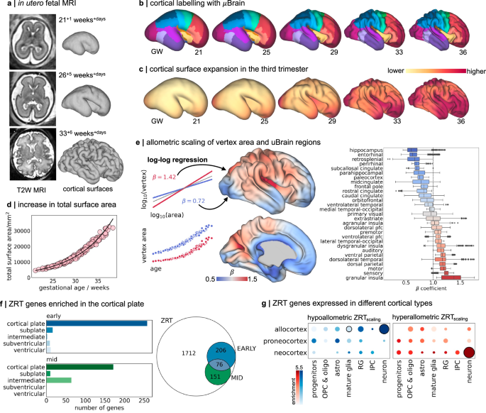 Fig. 3: Preferential cortical expansion during the third trimester.
