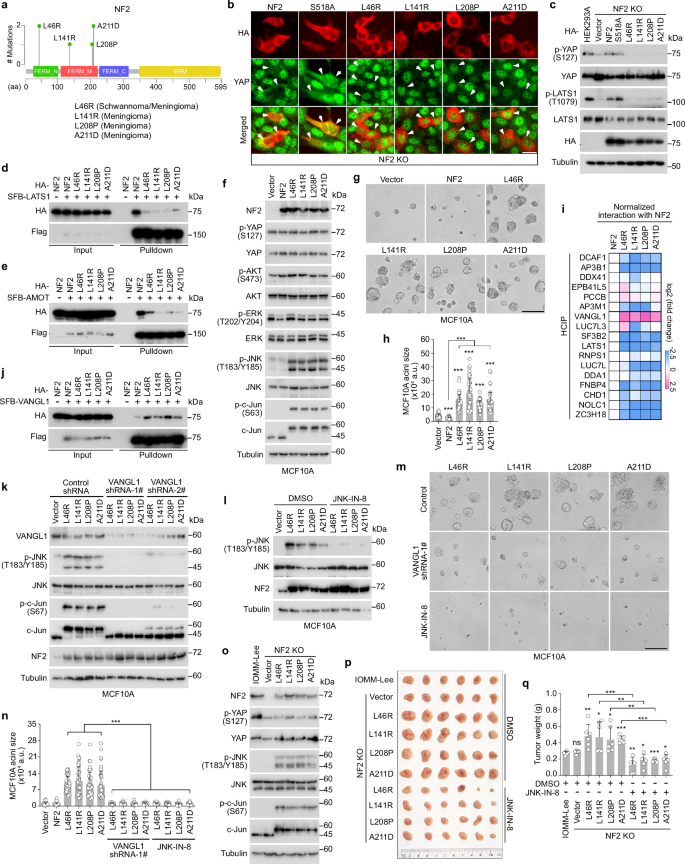 Fig. 7: The NF2 LOF mutations induce an oncogenic role of NF2 through the VANGL-JNK pathway.
