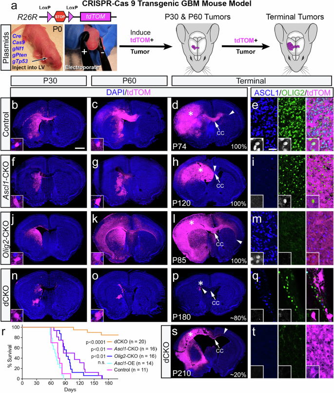 Fig. 2: ASCL1 and OLIG2 are required for tumor formation but inversely regulate different aspects of tumor migration in GBM mouse model.