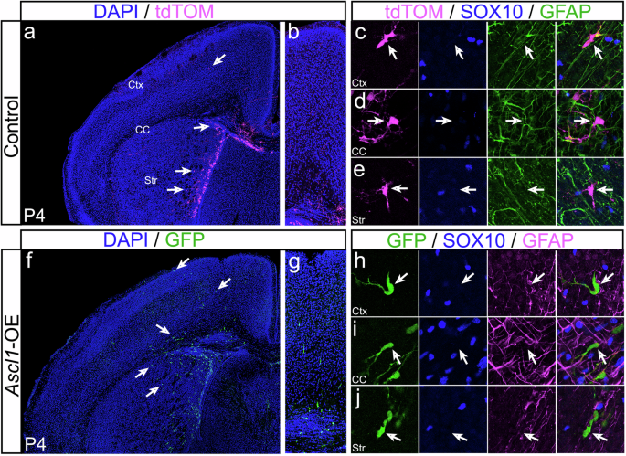 Fig. 5: ASCL1 overexpression promotes migration of newly transformed tumor cells.