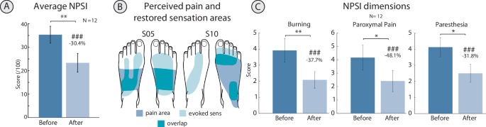 Fig. 5: Effects of one day of targeted neurostimulation on neuropathic pain reported by the participants.