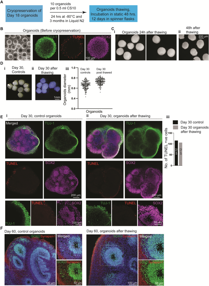 Fig. 5: Cryopreservation, thawing, and re-culturing of Hi-Q brain organoids.