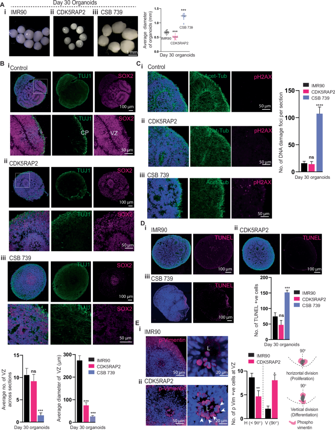 Fig. 6: Hi-Q brain organoids model microcephaly and brain organization defects.