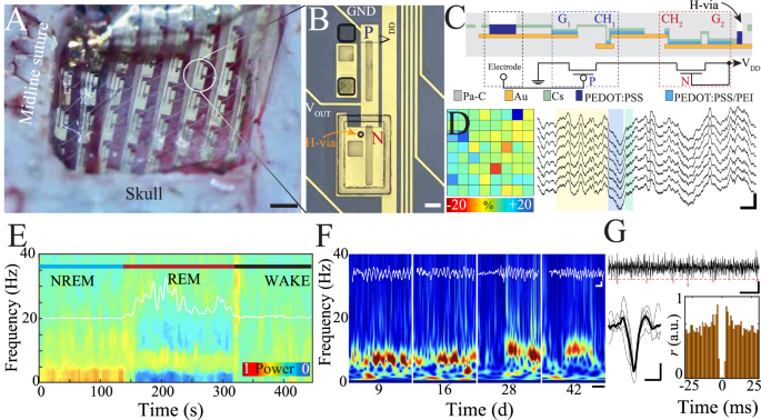Fig. 3: Conformable cIGT-based amplifier array for stable and chronic in vivo electrophysiological recordings at the resolution of individual action potentials.