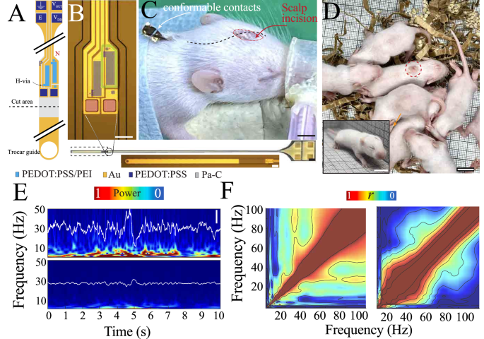Fig. 4: Fully implantable cIGT-based amplifier for acquisition of neural activity over the course of brain development.