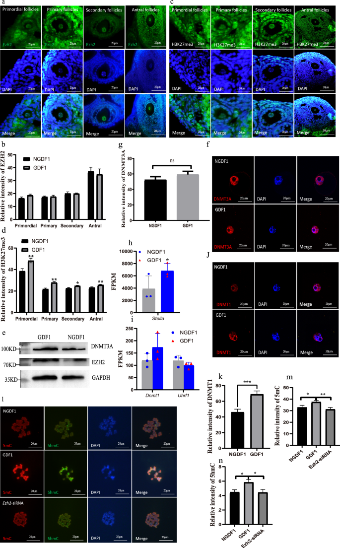 Fig. 8: Increased EZH2 mediates hyper-methylation in GDF1 oocytes via DNMT1.