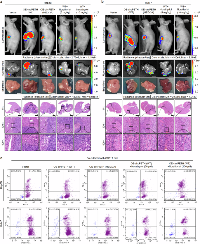 Fig. 6: Norathyriol inverts circPETH-147aa-facilitated intrahepatic metastasis of HCC cells and enhances tumor-killing effects of CD8+ T cells.