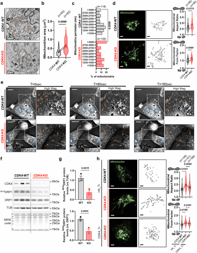 Fig. 4: CDK4 participates in mitochondrial fission of TNBC.