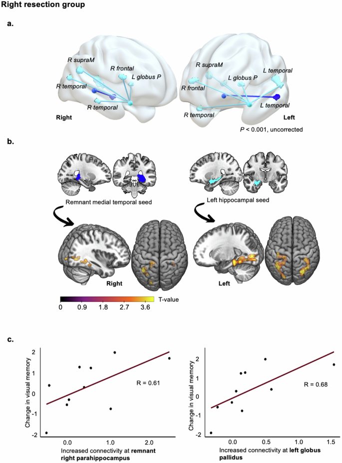 Long-term memory plasticity in a decade-long connectivity study post ...