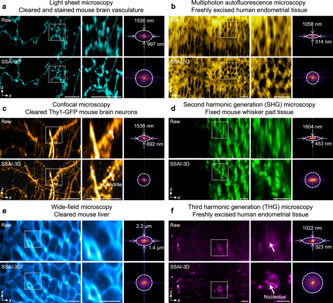 Fig. 5: SSAI-3D allows isotropic resolution recovery across different imaging systems and samples.