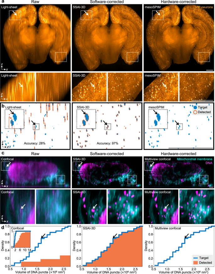 Fig. 6: Validated isotropic resolution recovery of SSAI-3D facilitates downstream biological analysis.