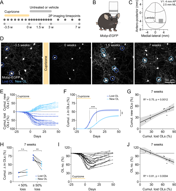 Incomplete remyelination via therapeutically enhanced  