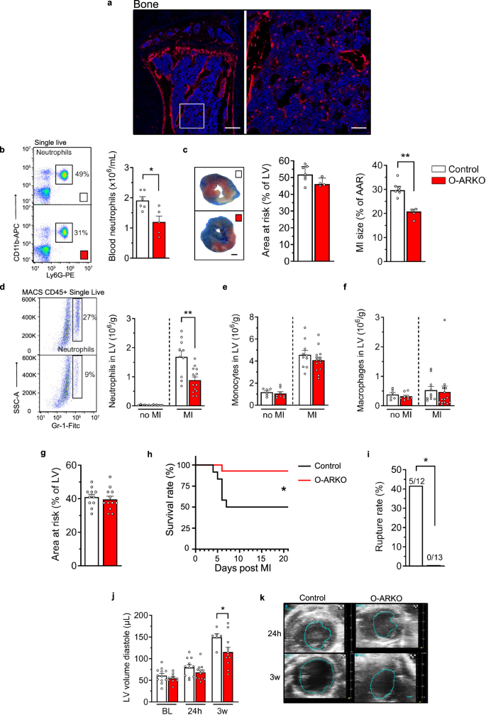 Fig. 2: Osterix-directed knockout of the androgen receptor reduces neutrophilia and cardiac remodeling and increases survival after an acute MI.