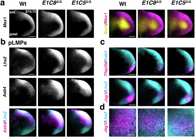Fig. 5: Opposing alterations in pLMPs and dLMPs in Grem1 tetradactyl limb buds.