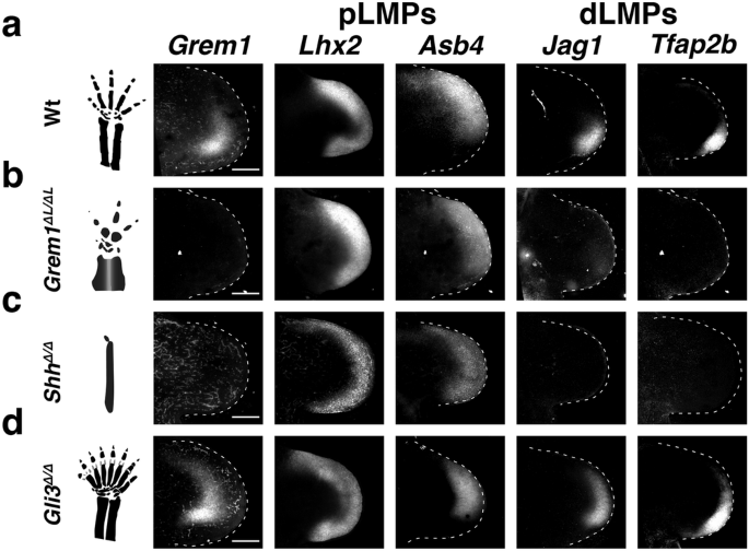 Fig. 7: RNA-FISH analysis of Grem1 and pLMP and dLMP marker genes in mouse models for human congenital malformations.