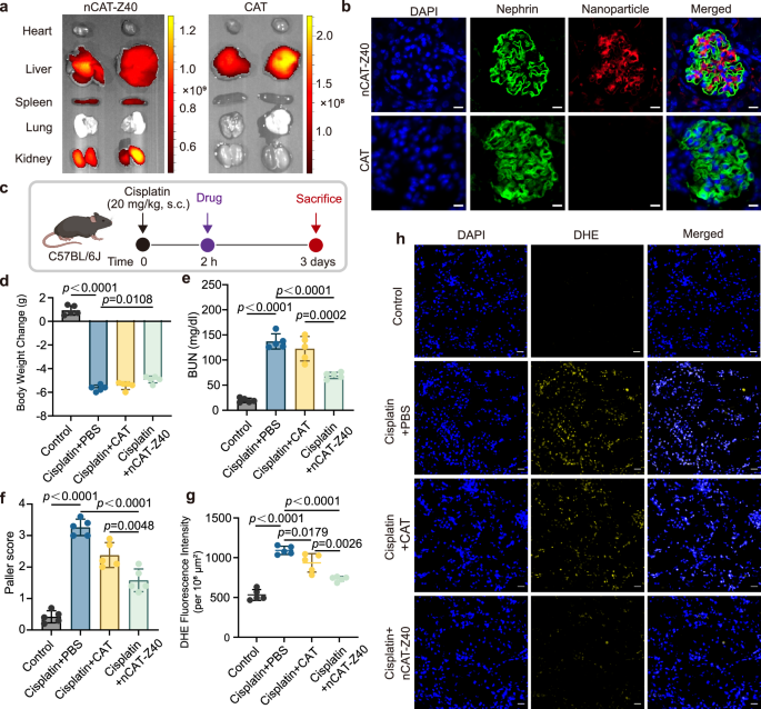 Fig. 6: nCAT-Z40 effectively reduced the cisplatin-induced acute kidney injury.