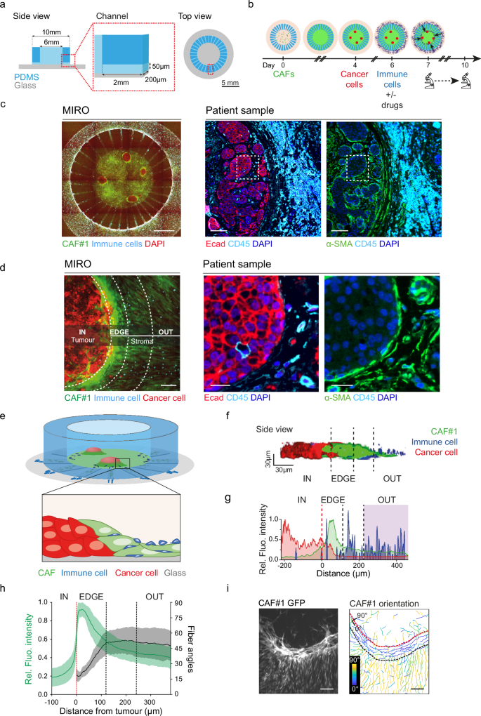 Fig. 1: On-chip reconstruction of a tumour/stroma boundary driving immune exclusion.