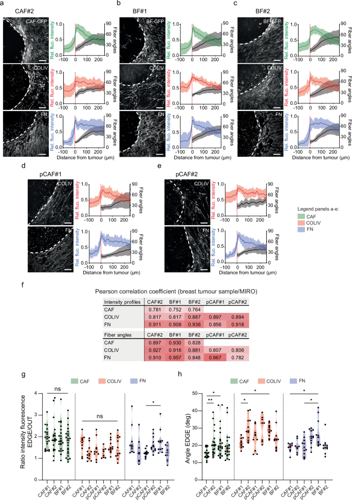 Fig. 3: Features of the tumour/stroma boundary formed with various types of fibroblasts.