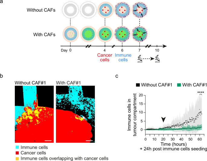Fig. 4: Stroma drives tumour immune exclusion in MIRO.