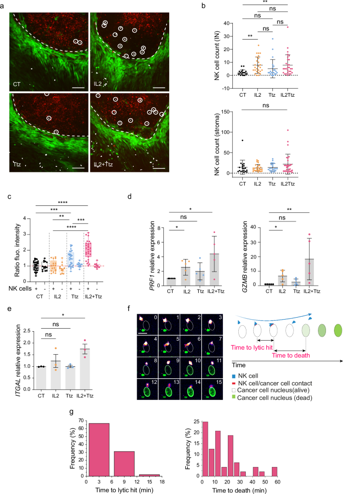 Fig. 8: Immuno-infiltration and ADCC quantification upon Interleukin 2 and Trastuzumab treatment in MIRO assays.