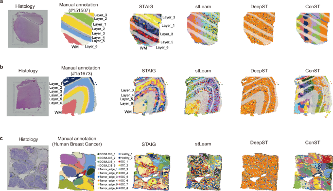 Fig. 3: Improving spatial transcriptomic analysis through advanced image feature extraction in STAIG.