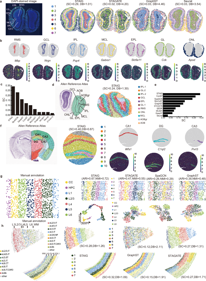 Fig. 4: Robust performance of STAIG in spatial transcriptomics lacking image data.