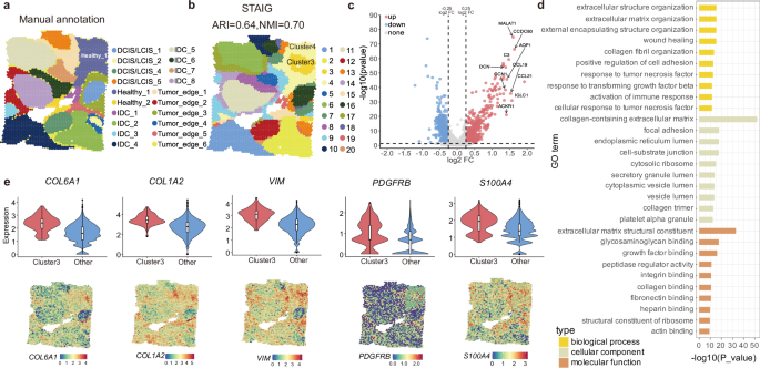 Fig. 6: Advanced spatial analysis by STAIG reveals cancer-associated fibroblasts (CAF)-rich clusters in human Breast Cancer ST Data.