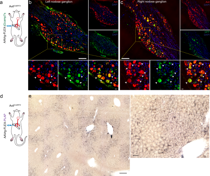 Fig. 2: Immunohistochemical identification of vagal sensory neurons innervating the liver.